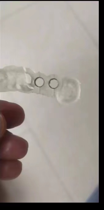 Стоматологический 3D-принтер и – обзор и цена 3D Printing Guide